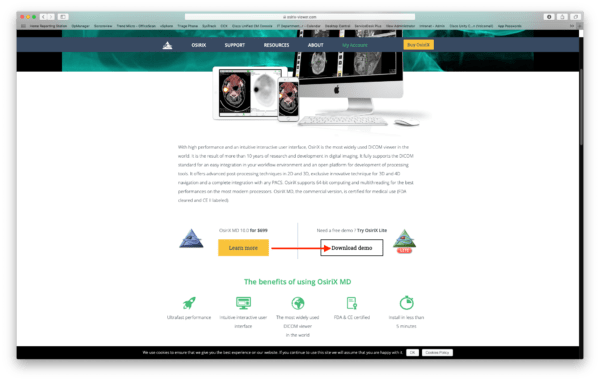 Download A Free Software To Open X Ray Disc Files For Mac