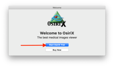get download link for osirix lite for windows get download link for osirix lite for windows