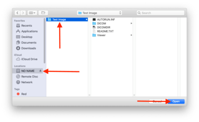 osirix lite dmg not recognised