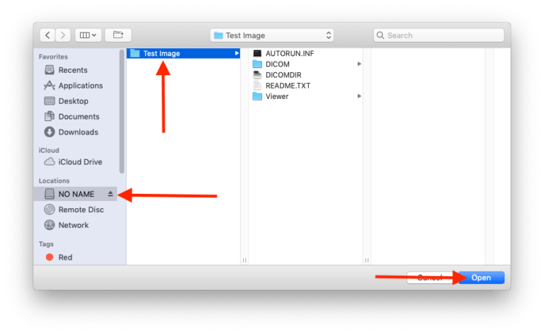 open osirix lite pc
