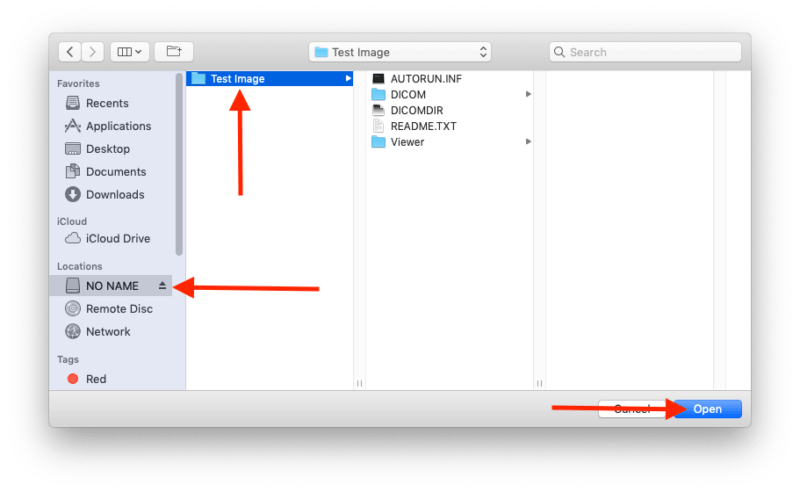 open osirix lite pc