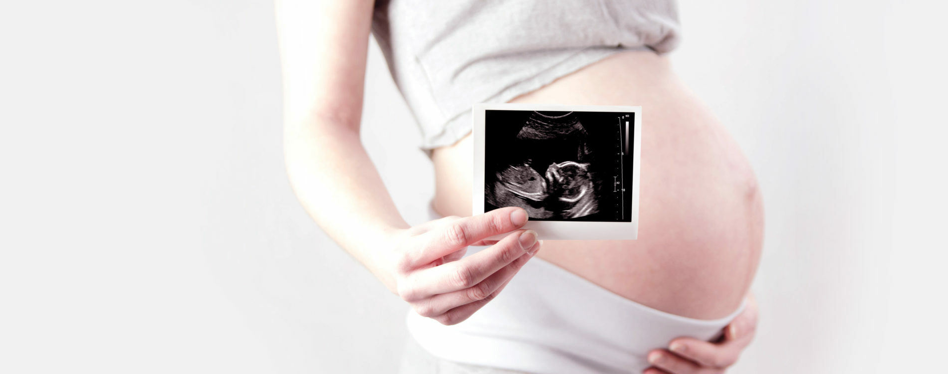 sonography-ultrasound