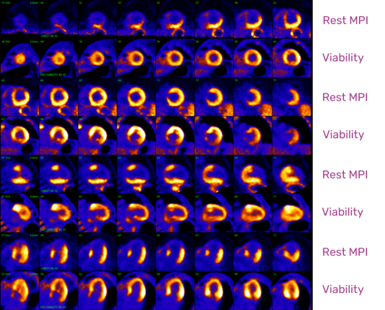 PET CT Practitioner Applications | MIC Medical Imaging