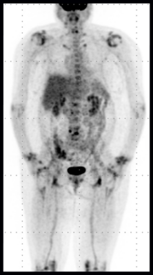 PET CT Practitioner Applications | MIC Medical Imaging