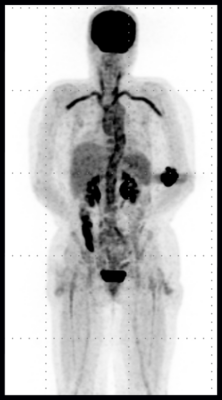 PET CT Practitioner Applications | MIC Medical Imaging