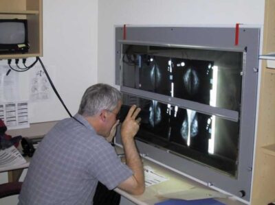 Breast-Imaging-Analog-Film-radiologist
