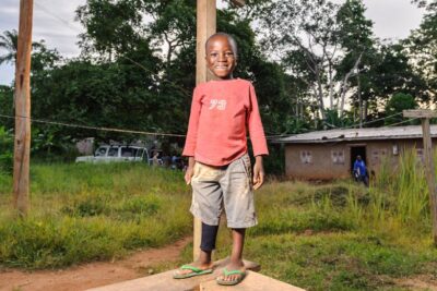 Gallery-Pierre-after-surgery